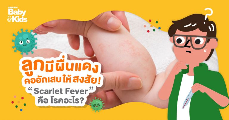 scarelet fever โรคไข้อีดำอีแดง